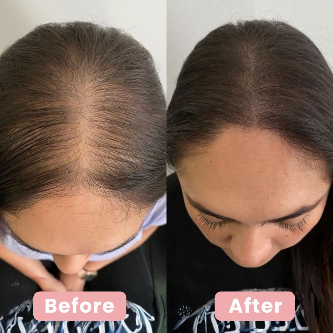 4 in 1 Hair Renewal Brush